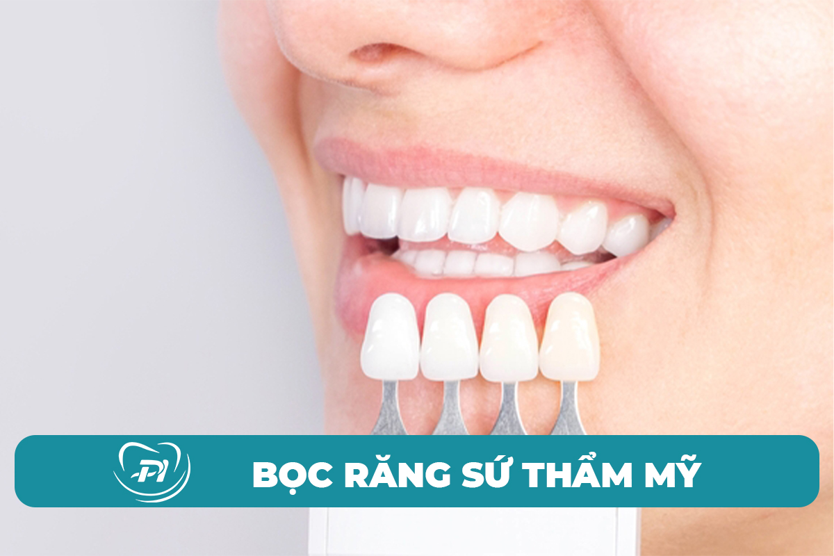 Bọc răng sứ thẩm mỹ tại Hạ Long
